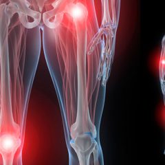 Боль в области коленного сустава при сгибании и разгибании. Основные причины и способы лечения