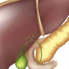 Основы диеты после удаления желчного пузыря