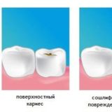 Эффективные методы профилактики кариеса, такие как правильное питание, регулярная гигиена полости рта, ежегодные посещения зубного врача.